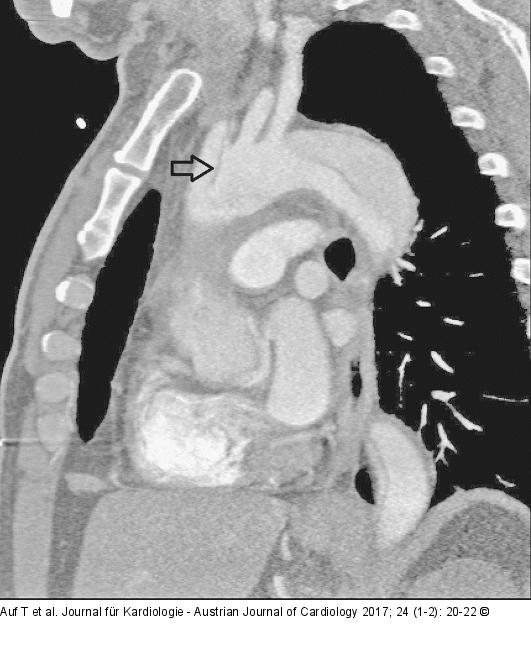 CT-Angiographie