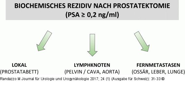 Biochemisches Rezidiv