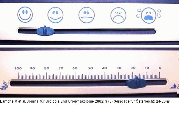 Visuelle Analog-Skala - Schmerzintensitt