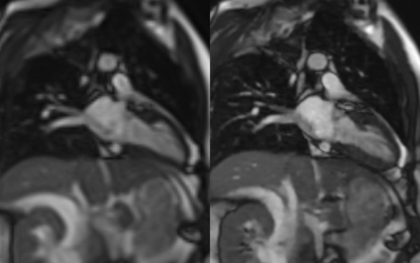 Produkt: MRT-Scan<br>Vertrieb: Siemens Healthcare