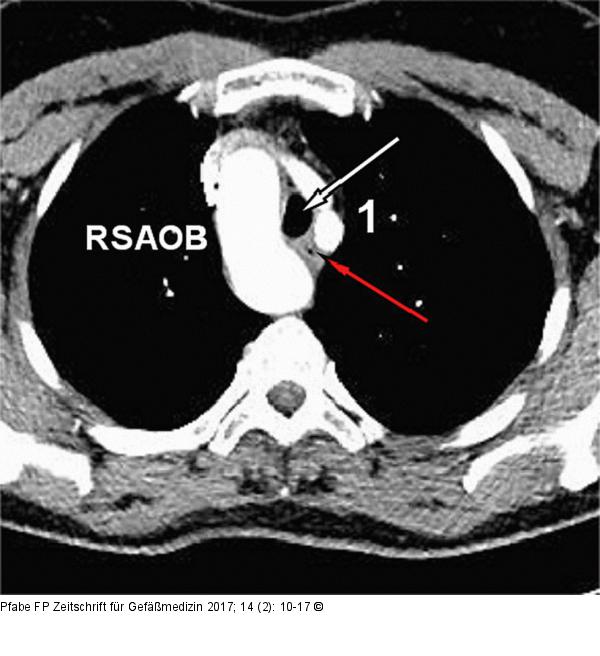 CT-Angiographie
