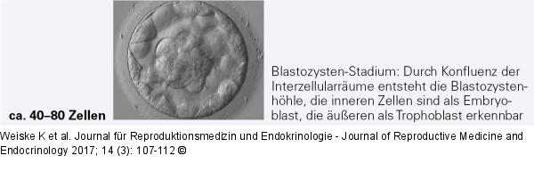 Blastozyste