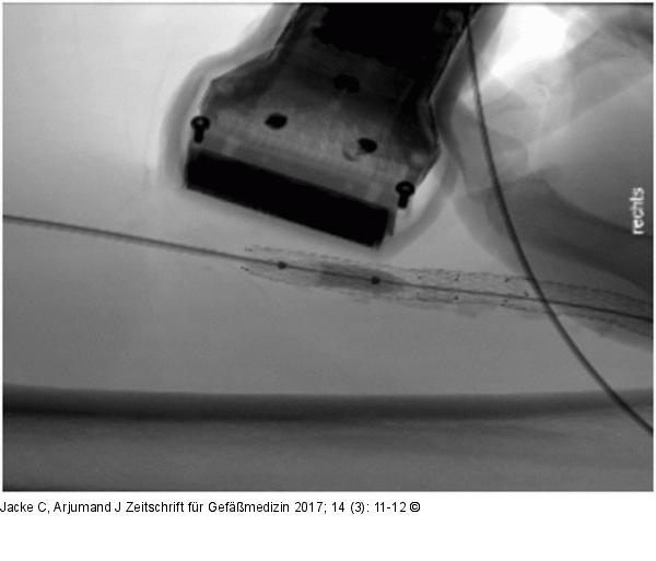 Radiologische Kontrolle