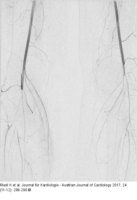Periphere Angiographie