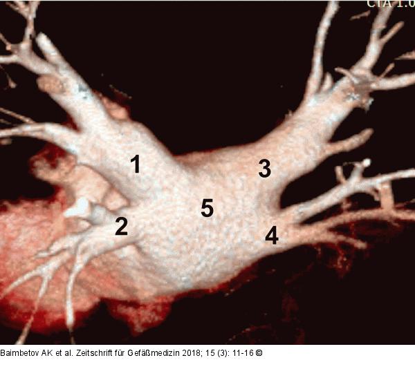 Multispiral CT