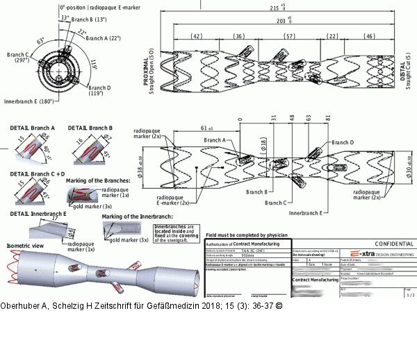 Produkt: Stentgraft<br>
Vertrieb: Jotec GmbH