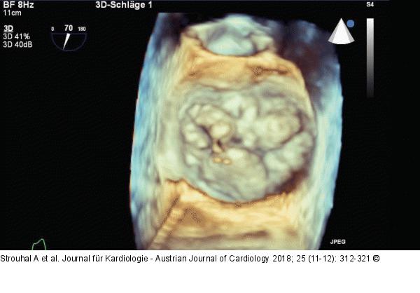 Surgical view