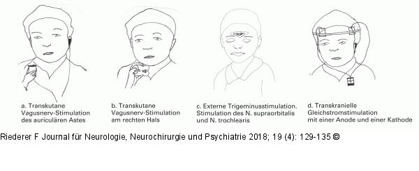 Neuromodulation