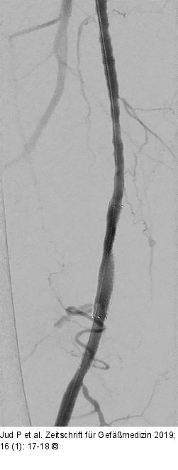 A. femoralis superficialis