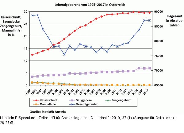 Entwicklung