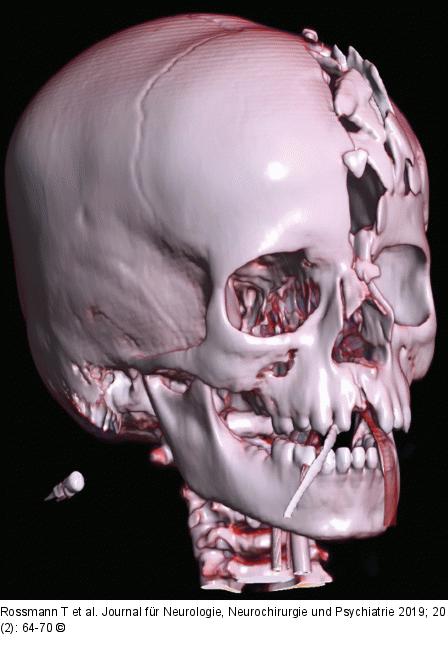 3D-Rekonstruktion
