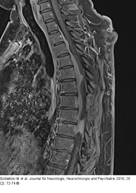 Postoperative MRT-Bildgebung