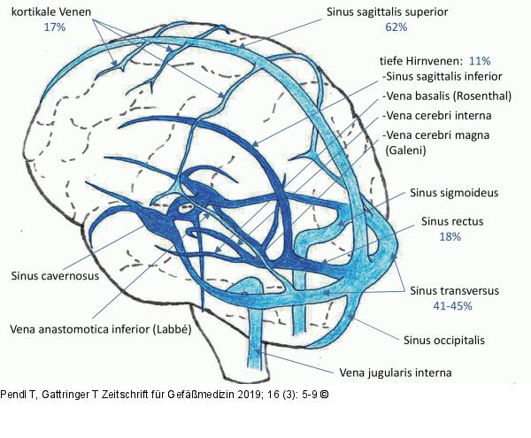 Zerebrales Sinusvenensystem