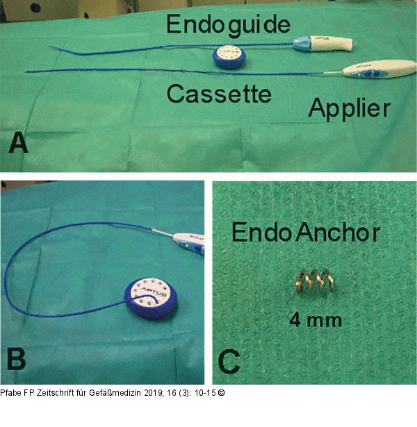EndoAnchor