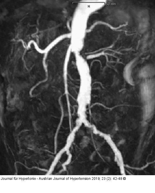 MR-Angiographie