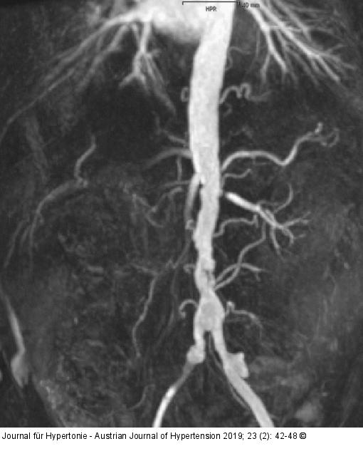 MR-Angiographie