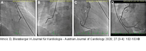 Angiographie