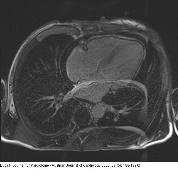 Magnetresonanztomographie