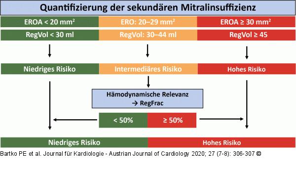 Sekundre Mitralinsuffizienz