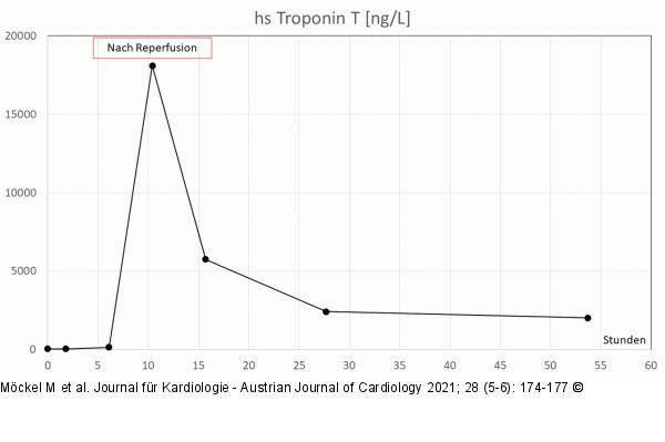 hs-Troponin T
