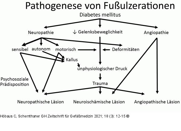 Fuulzeration