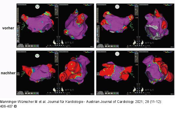 Elektroanatomisches Mapping
