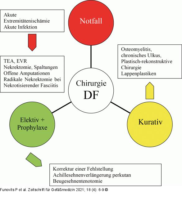 Chirurgie - Diabetischer Fu