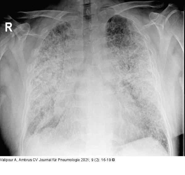 Radiologischer Befund