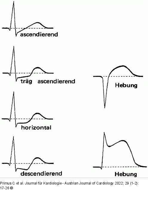 EKG-Beurteilung