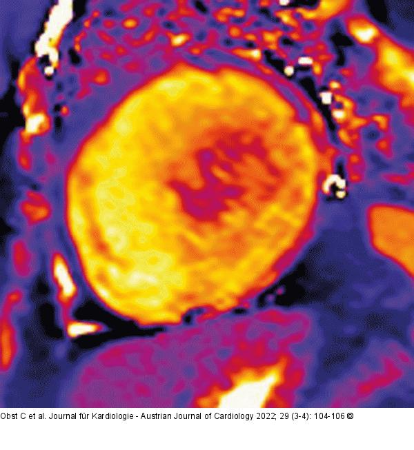 Short-axis view T1 mapping