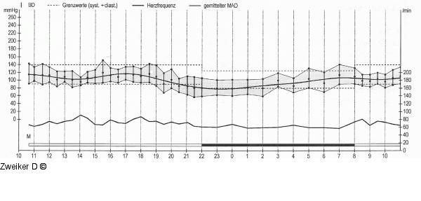 Ambulantes Blutdruckmonitoring