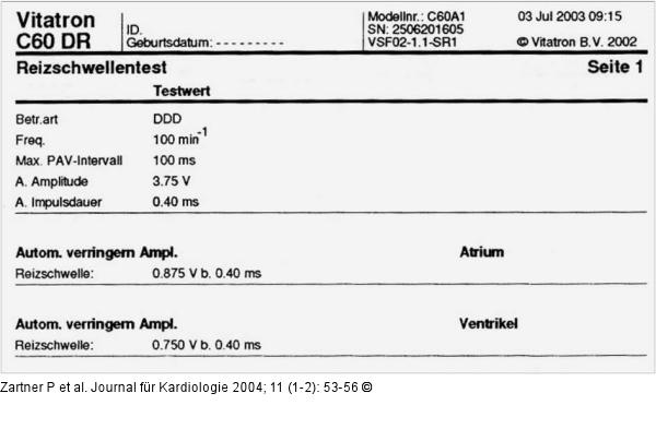 Schrittmacher - Reizschwellentest
