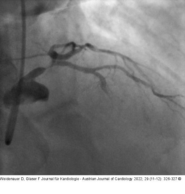 Angiographie
