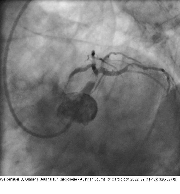 Angiographie