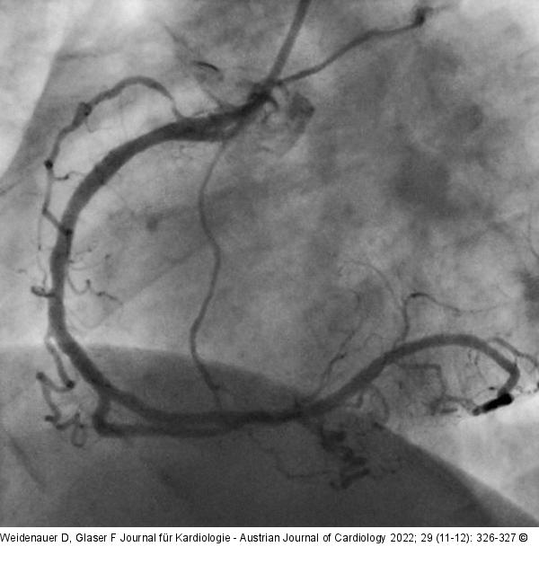 Angiographie
