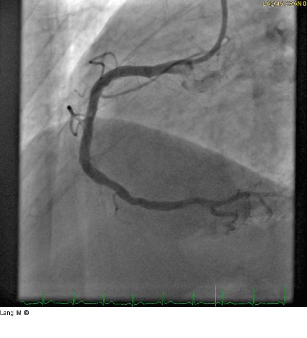 Angiogramm