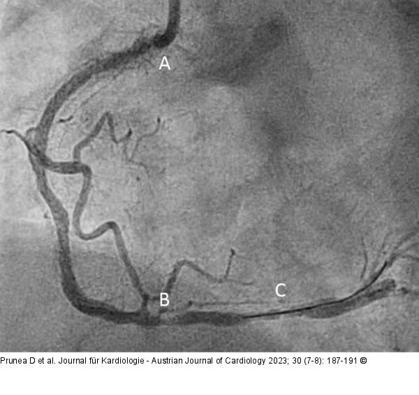 Angiographie