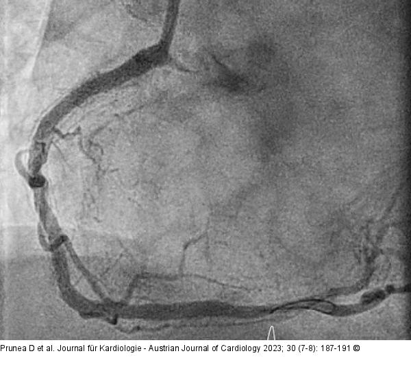Angiographie