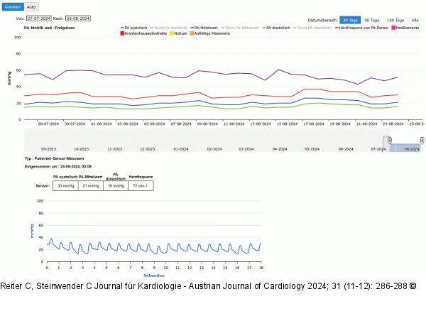 CardioMEMS HF-System - Medizinisches Monitoring