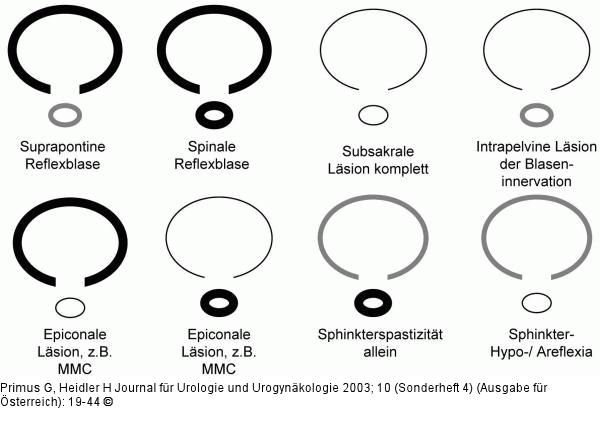 Blasenfunktionsstrung