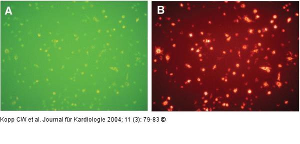 Endotheliale Progenitorzellen