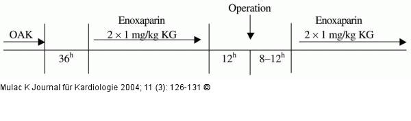 Orale Antikoagulation - Chirurgische Eingriffe