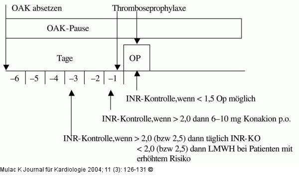 Orale Antikoagulation - Chirurgische Eingriffe