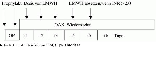 Orale Antikoagulation - Chirurgische Eingriffe