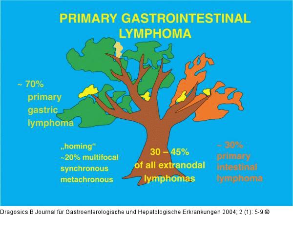 Primres gastrointestinales Lymphom