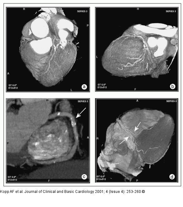 MDCT-Computertomographie