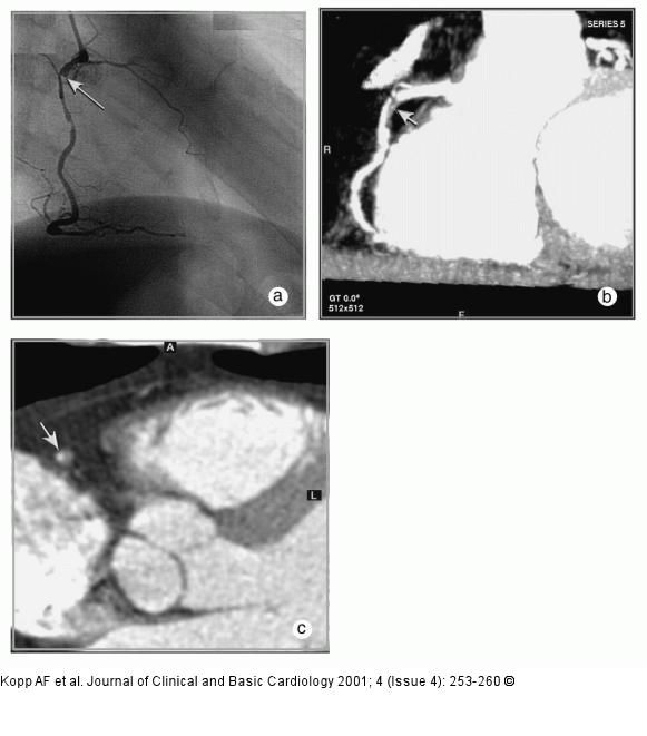 MDCT-Computertomographie