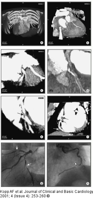 MDCT-Computertomographie