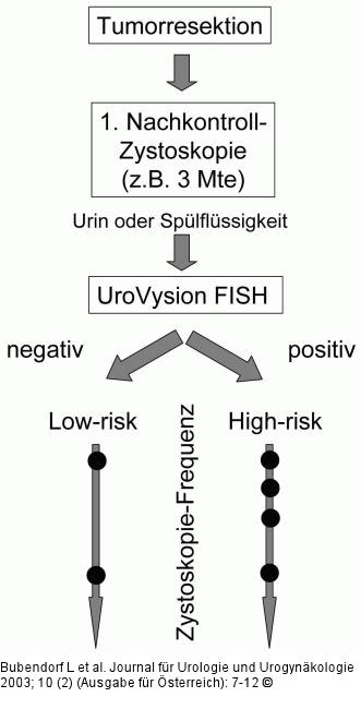 UroVysion-Test
