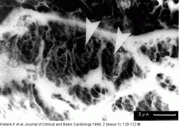 Gefrierschnitt Aorta